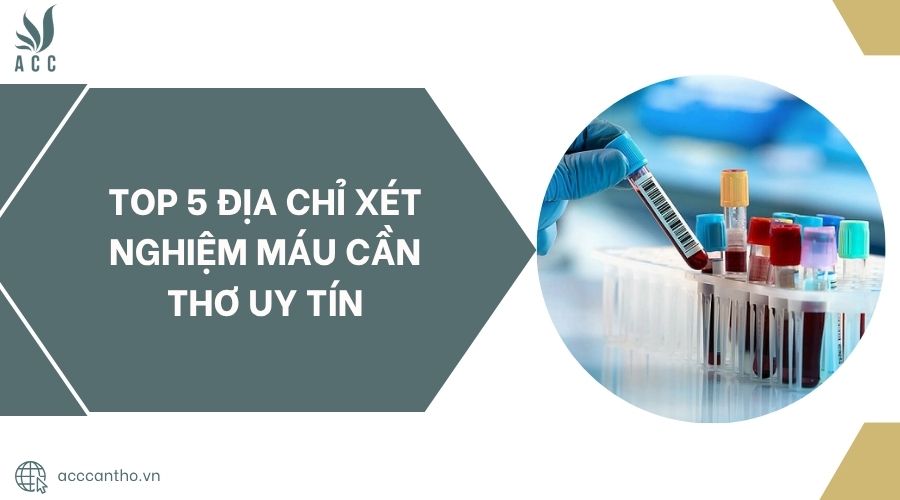Top 5 Địa chỉ xét nghiệm máu Cần Thơ uy tín.jpg