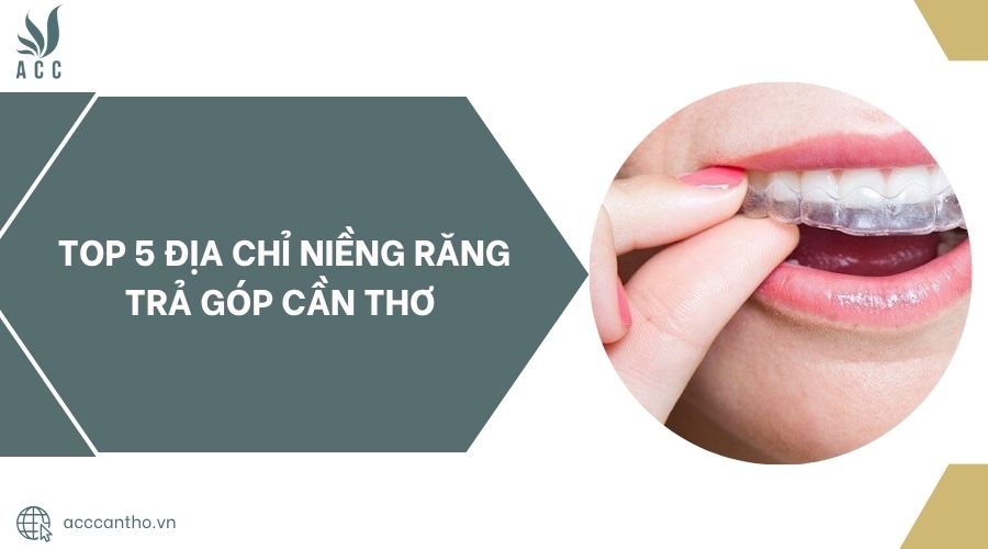 Top 5 địa chỉ niềng răng trả góp Cần Thơ.jpg
