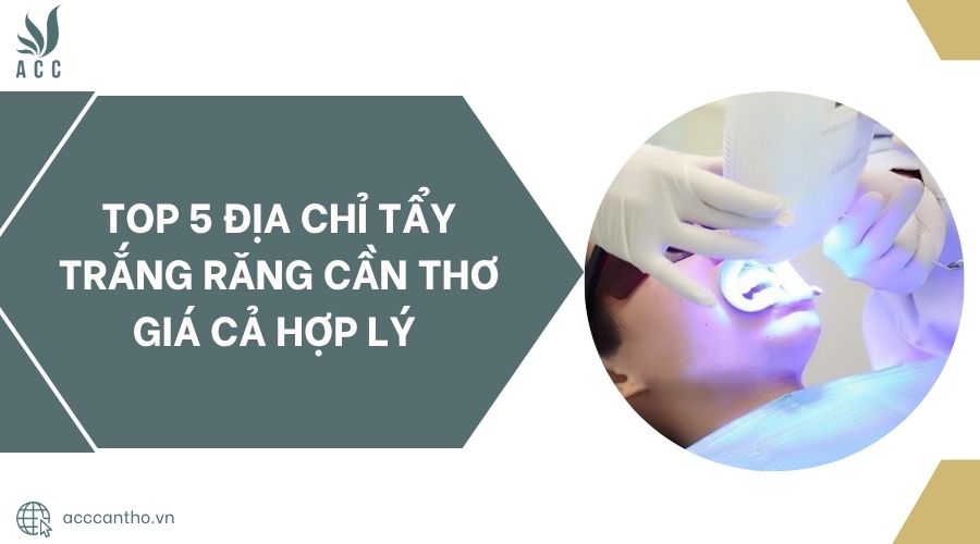 Top 5 địa chỉ tẩy trắng răng Cần Thơ giá cả hợp lý 