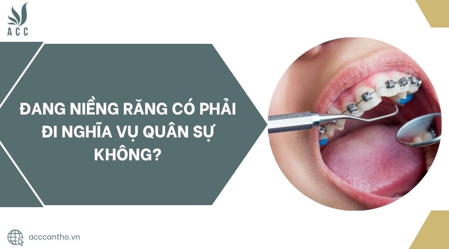 Đang niềng răng có phải đi nghĩa vụ quân sự không?
