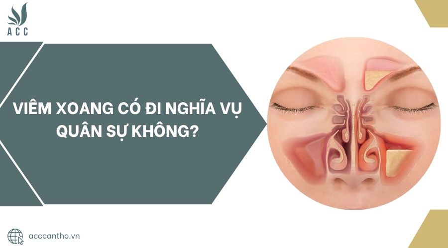 Viêm xoang có đi nghĩa vụ quân sự không?