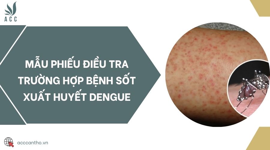 Mẫu phiếu điều tra trường hợp bệnh sốt xuất huyết Dengue